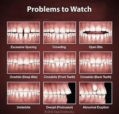 Orthodontic Problems.
