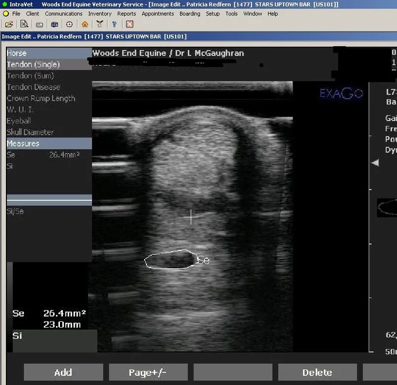ultrasound