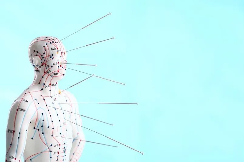 Man with acupuncture needles on back