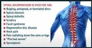 Sciatica and Herniated Disc Relief