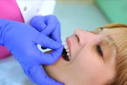 dentist's gloved hand placing veneer piece on woman's front tooth, porcelain veneers Kanata, ON dentist