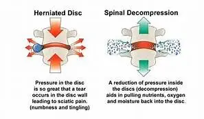 Disc Hydration