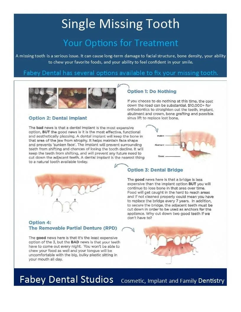 Single Missing Tooth
