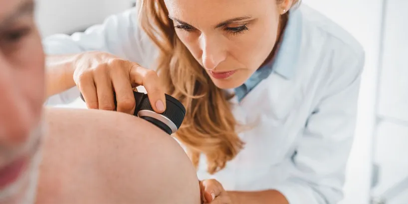 Skin Cancer in Tustin, CA