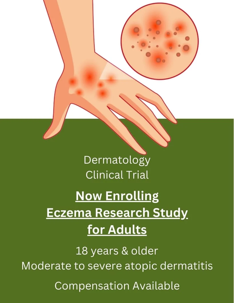 Eczema Research Study for Adults