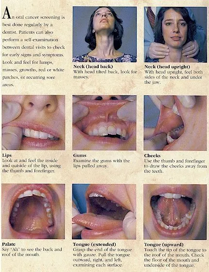 Oral Cancer Self Exam