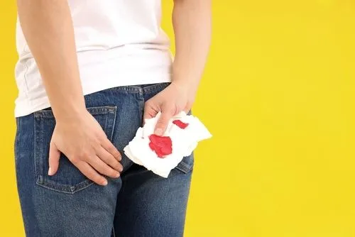 Woman holding tissue with blood, experiencing rectal bleeding
