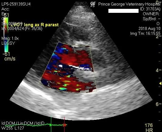 Echocardiography