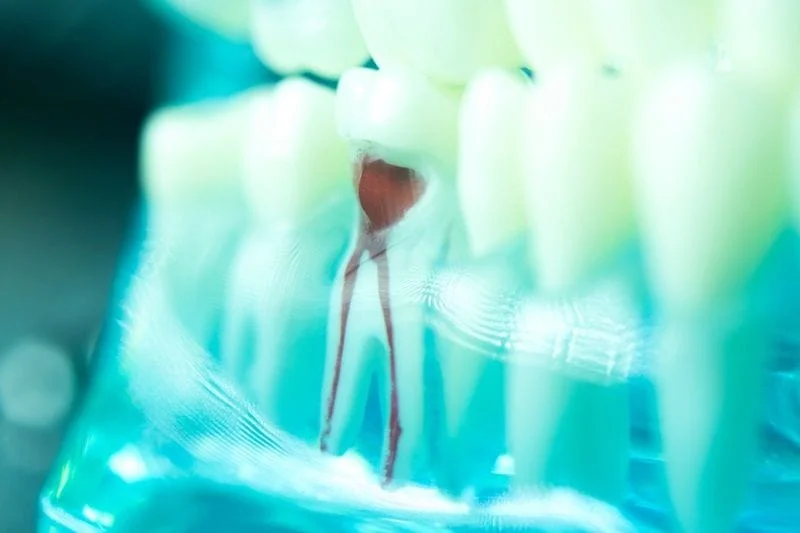 endodontics