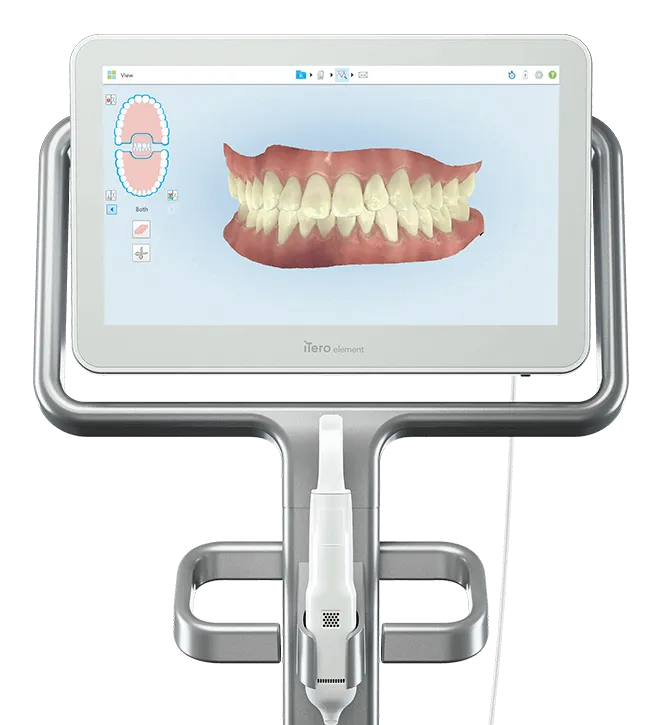 itero scanner