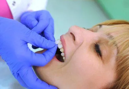 dentist's gloved hand placing porcelain veneers onto woman's front teeth, veneers Roslyn, NY dentist