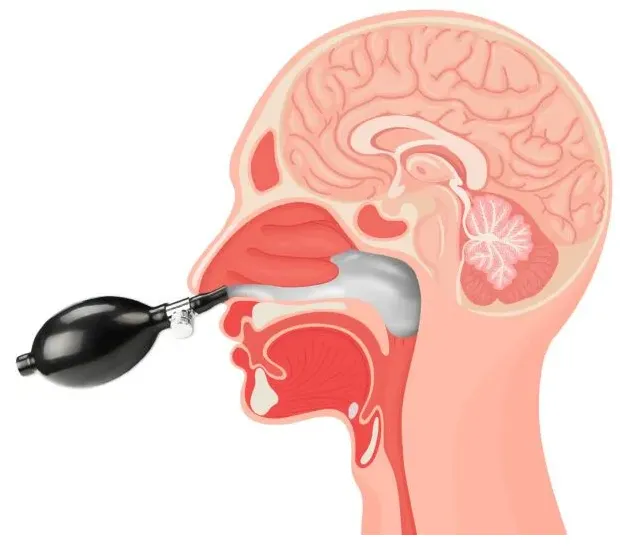 Cranial Facial Release 2