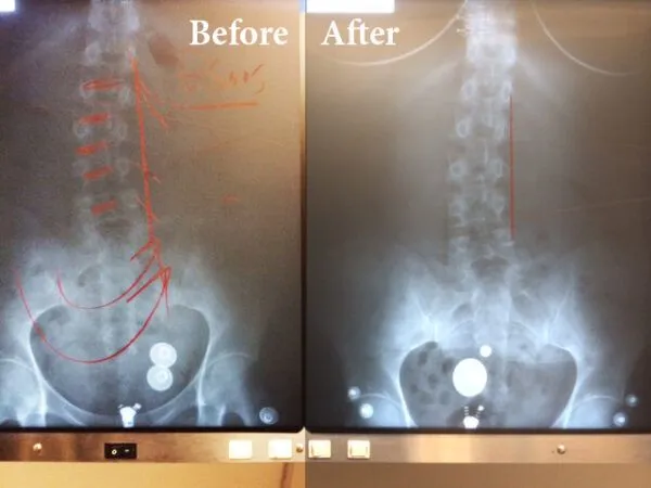 Active Therapeutic Movement