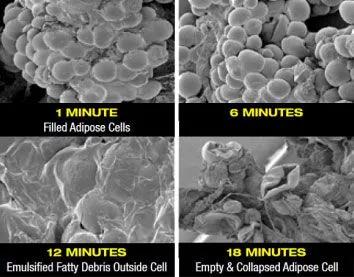 Fat cells