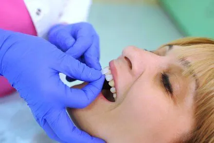 dentist's gloved hand placing veneer piece on woman's front tooth, veneers Melrose, MA cosmetic dentistry
