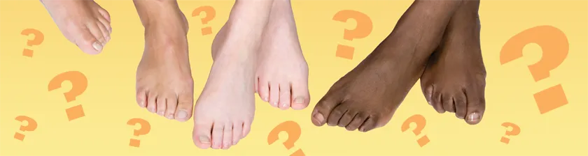 Foot Questions