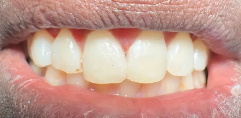 Cosmetic Dentistry in Reston, VA