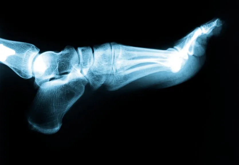 Bridgeton Podiatrist | Bridgeton Plantar Fasciitis | NJ | Scott A. Fishman, D.P.M. |