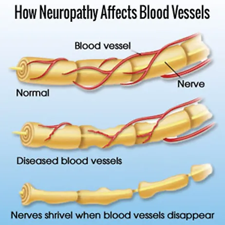 Blood Vessels