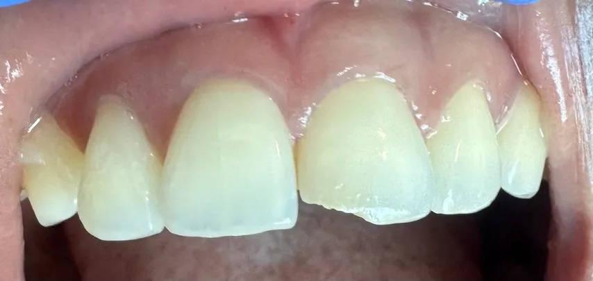 Cosmetic Dentistry in Reston, VA