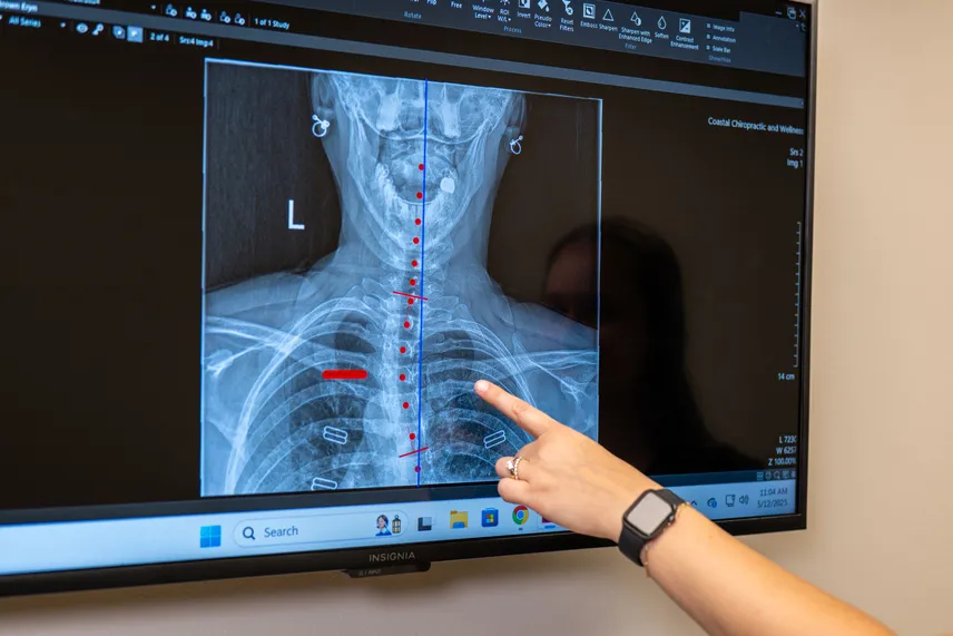 Female with back pain