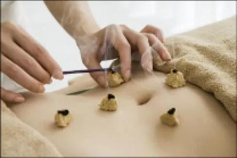 MOXIBUSTION