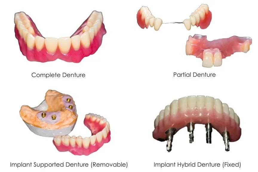 Temporary Dentures vs. Permanent Dentures - Pickett Family Dental