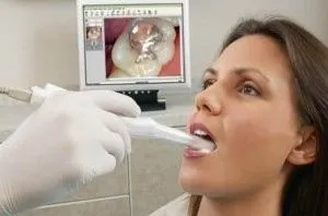 interoral_camera_dental_video_camera_300x198.jpg