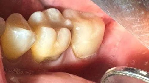 Cosmetic Dentistry in Reston, VA