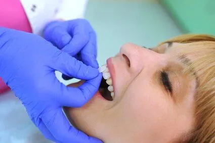dentist's gloved hand applying veneers to woman's front teeth, dentist Mount Kisco, NY veneers