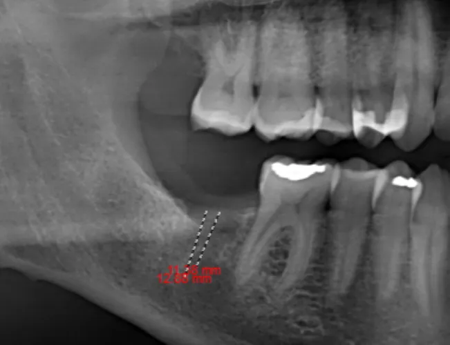 Cosmetic Dentistry in Reston, VA