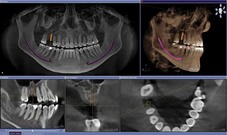 cbct