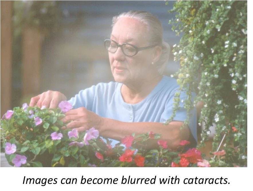 Blurred image with cataracts