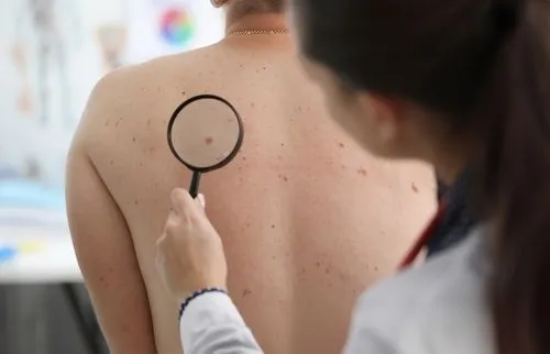 Dermatology total body skin screening for male patient.