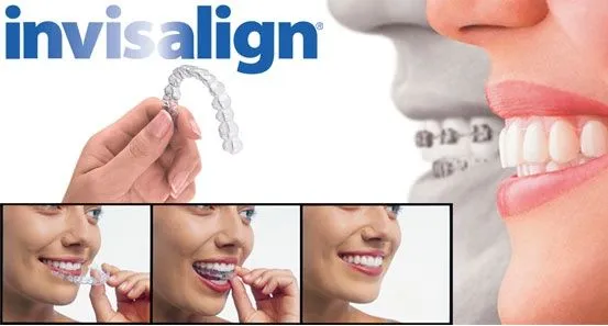 invisalign_postcard.jpg