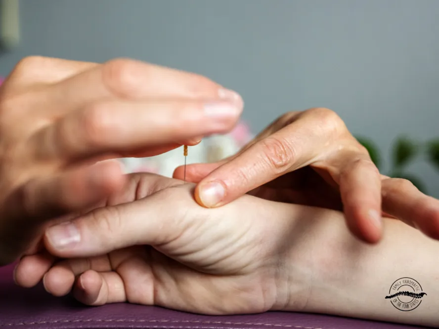 Acupuncture at Dr. Russell McDaniel's Office Family Chiropractic of the 4 States is safe for children to seniors