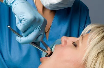 dentist using tool to extract tooth from woman's mouth, tooth extractions Brookline, MA dentist