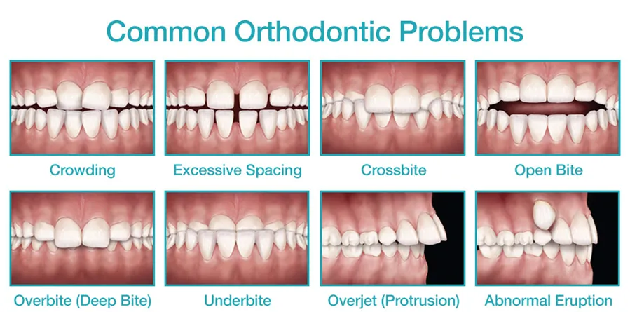 common ortho problems