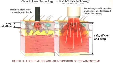 Description: http://hullchiropractic.com/clients/18491/images/LASER_DEPTH_OF_PENETRATION_CLASS_3_VS._CLASS_4.jpg