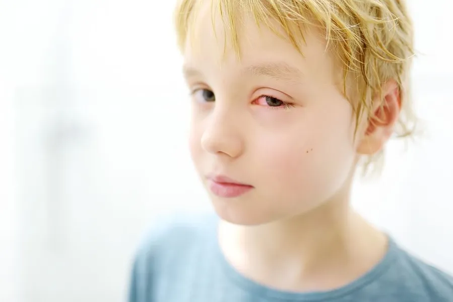 Preteen boy with eye infection.