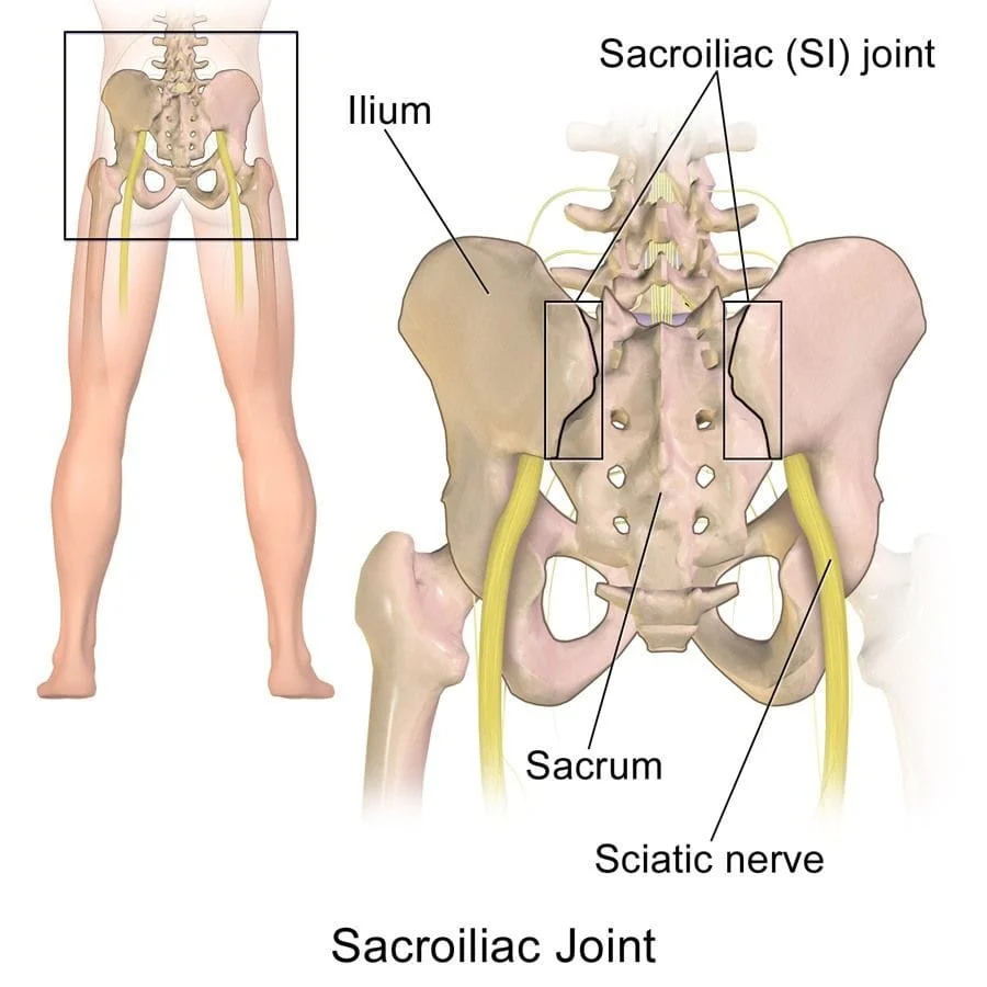 Sacroiliac joint pain NYC. The sacroiliac joint is often the cause of most back pain. Chiropractors focus more attention on the role that the sacroiliac joint plays in relation to the spine, versus medical doctors who tend to overlook it as a cause of back pain.