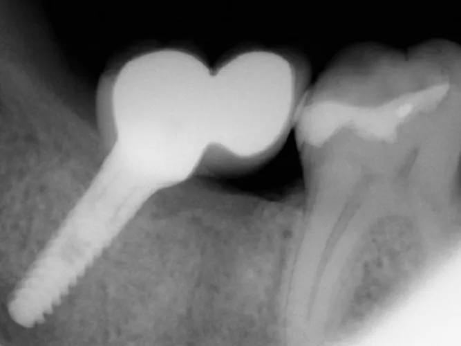 Cosmetic Dentistry in Reston, VA