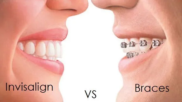 invisalign in Colorado Springs 