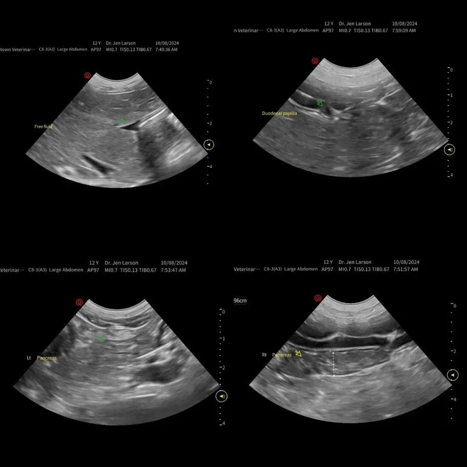 Ultrasound