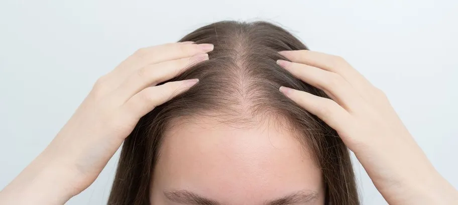 Man before and after hair loss treatment