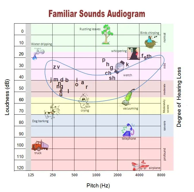 Audiogram