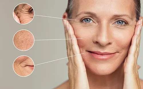 aging skin