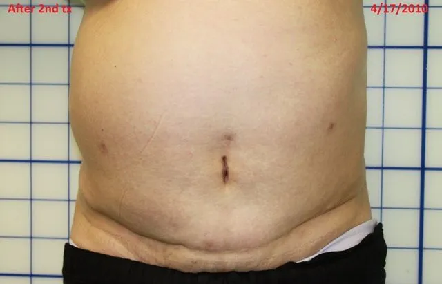 Optimal Chiro-Rehab Center