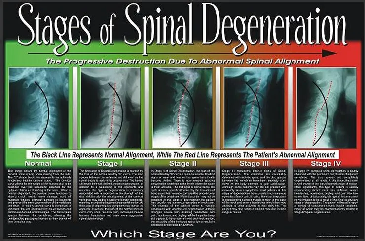 spinal_large_series_good.jpg