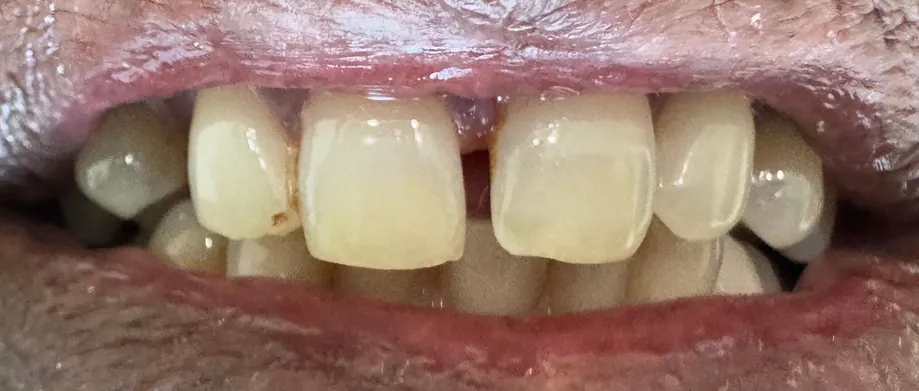 Cosmetic Dentistry in Reston, VA